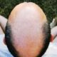 how shave bald head 1516196127