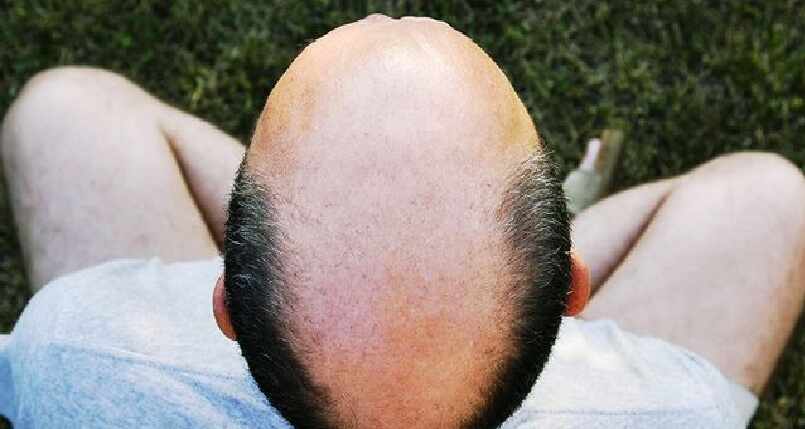 how shave bald head 1516196127
