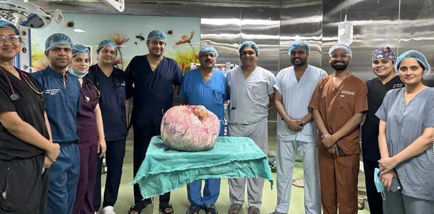 doctors removed 15kg tumour from ladys stomach indore