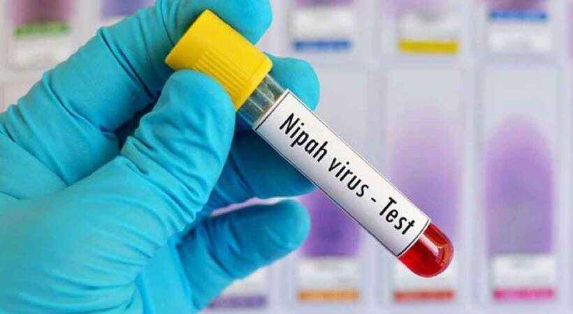 nipah virus