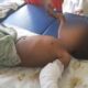One and a half year old boy beaten by his mothers friend